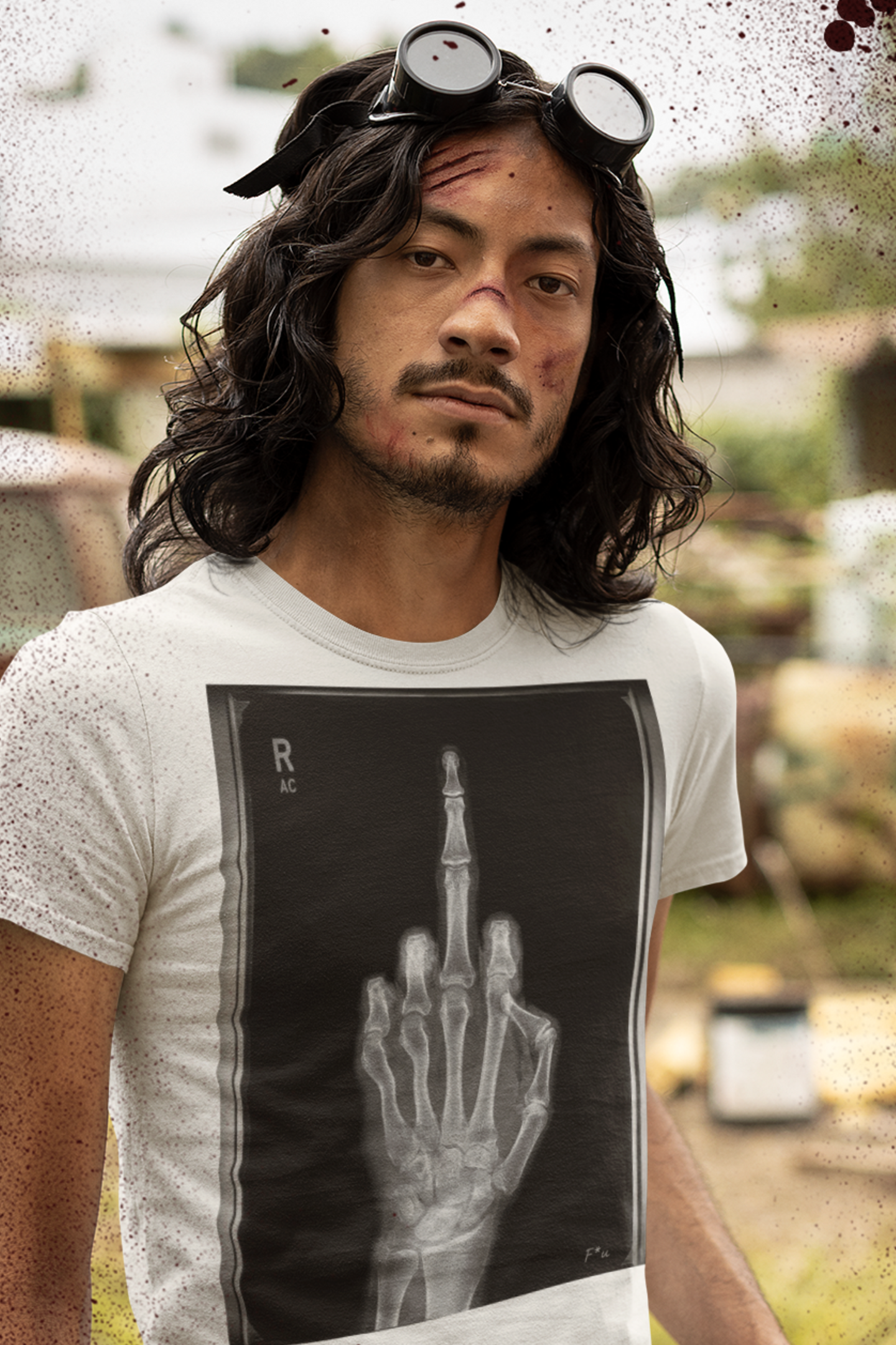 X-Ray Middle Finger