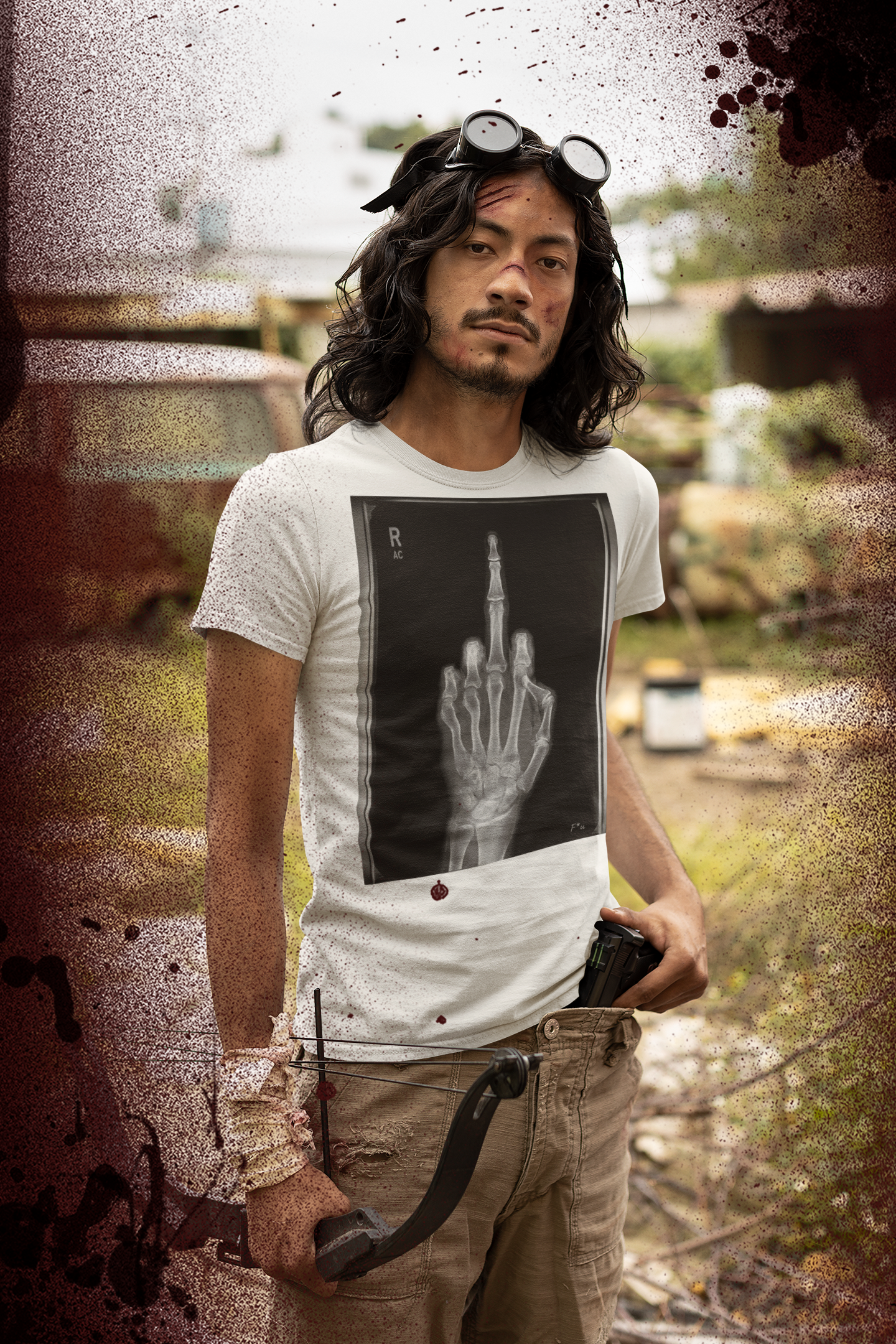 X-Ray Middle Finger